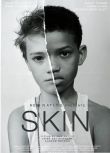 2018高分劇情短片《膚色/皮膚/Skin 》朗尼·查維斯.英語中字